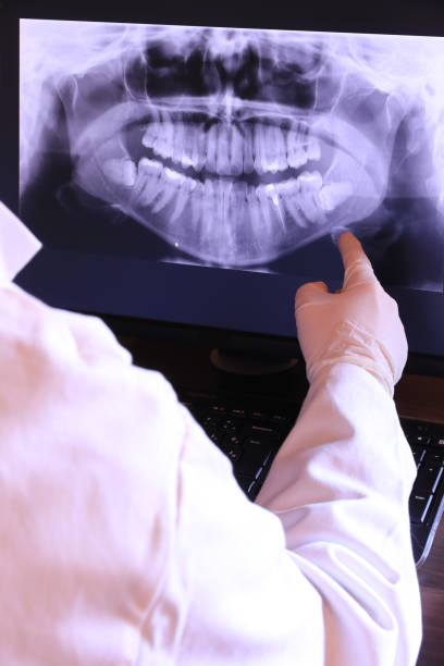 Best Emergency Dental Care for Abscessed Tooth in New Market, VA